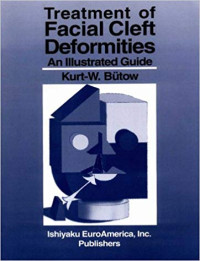 Treatment facial Cleft Deformities. An Illustrated guide