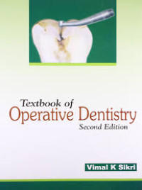 Textbook of Operative Dentistry, 2e