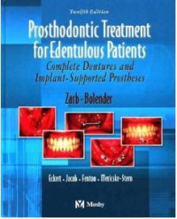 Prosthodontic Treatment for Edentulous Patients, 12e (GEORGE A.ZARB, CHARLES L. BOLENDER)