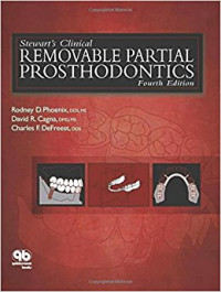 Stewart's Clinical Removable Partial Prosthodontics, 4e