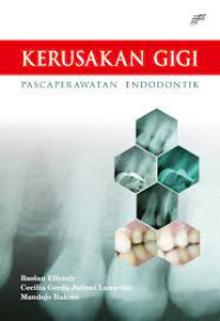 Kerusakan gigi pasca perawatan Endodontic