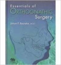 Essential of Orthognathic Surgery