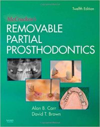 McCracken's Removable Partial prosthodonsia, 12e