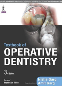 Textbook of Operative Dentistry, 3e